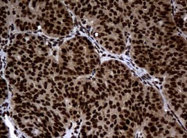 PCNA Antibody (clone OTI6A10)