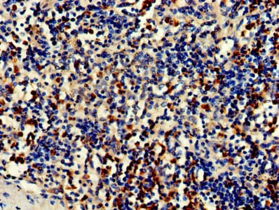 CDA / Cytidine Deaminase Antibody