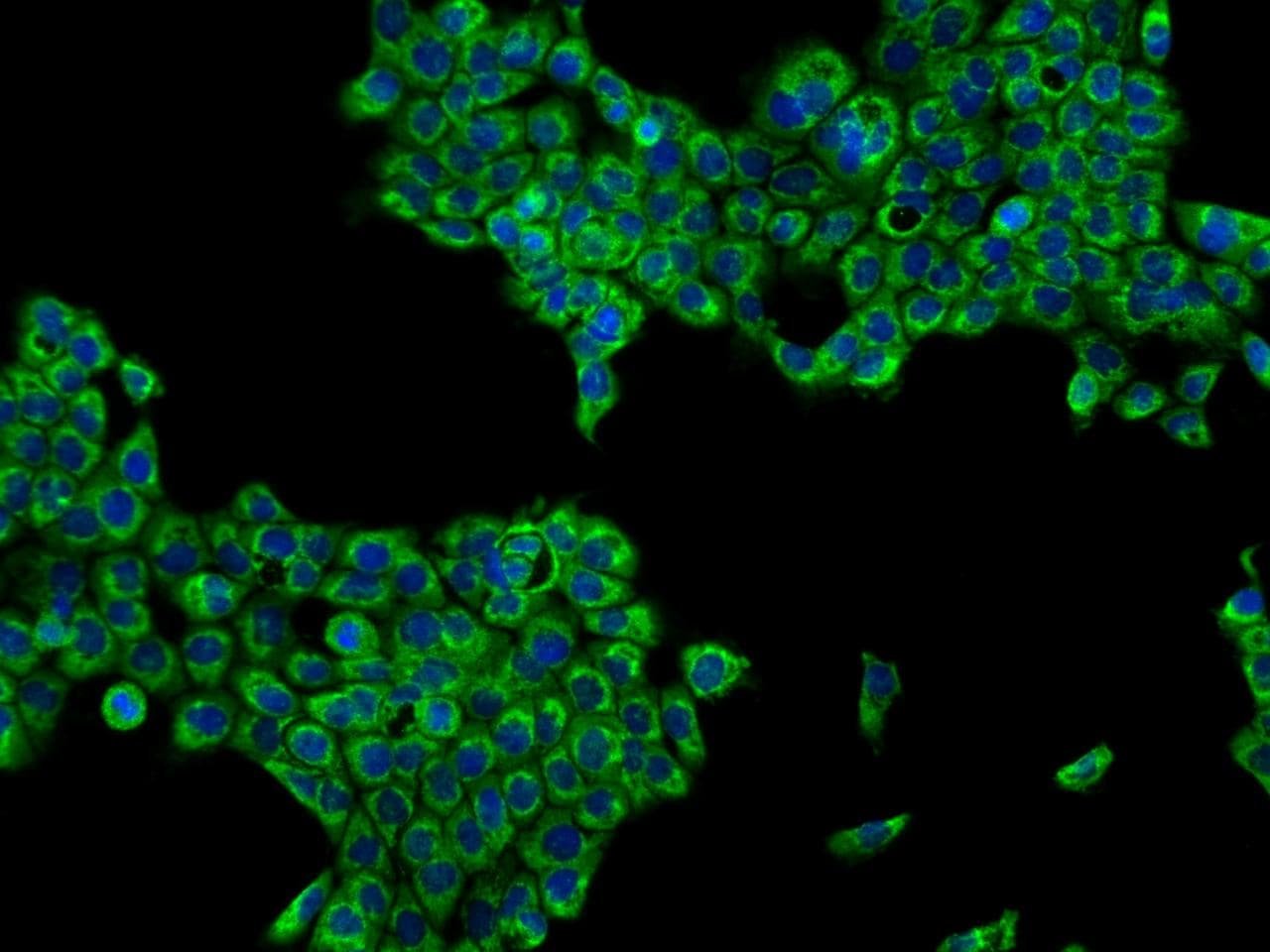 PPM1D / WIP1 Antibody
