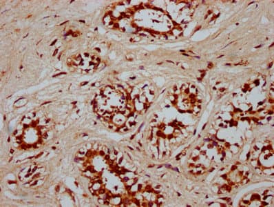 POU5F1B Antibody