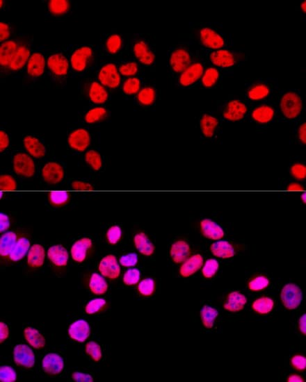 IHC-plus™ SFPQ Antibody