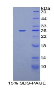 Rat CXCL16 Protein (Recombinant His-T7)