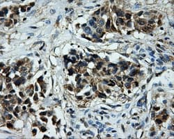 KIAA0153 / TTLL12 Antibody (clone OTI1A2)