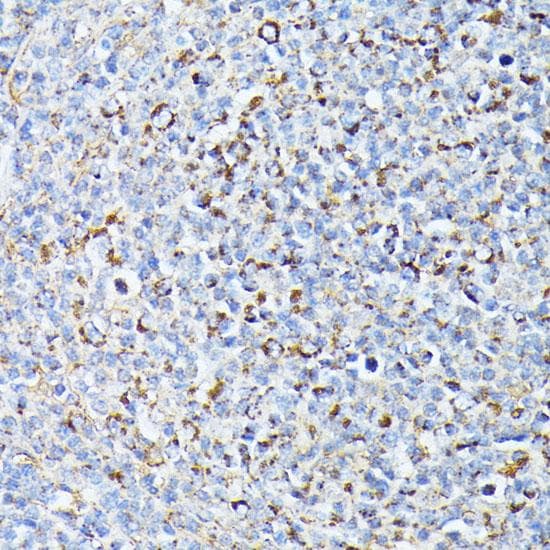 TP53I11 / PIG11 Antibody
