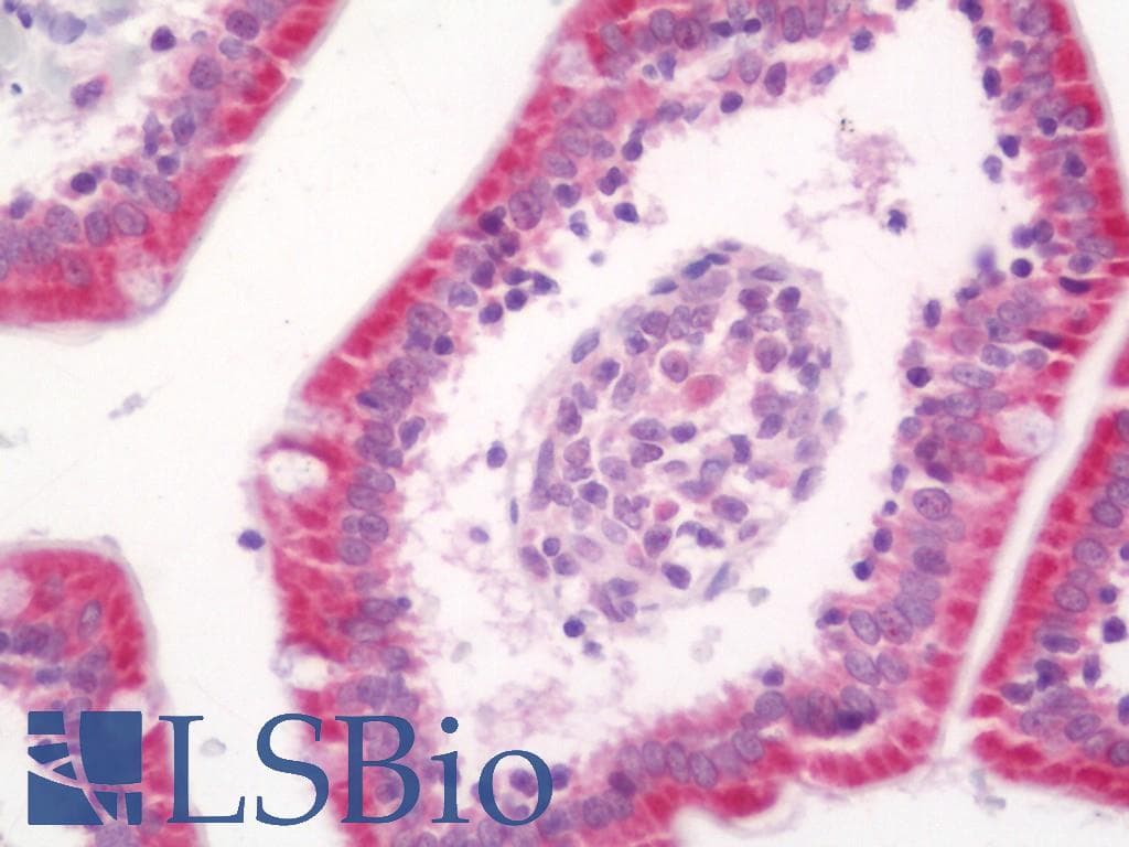 IHC-plus™ ARHGEF5 Antibody (aa1251-1300)