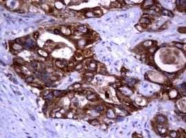 PIK3CD / PI3K Delta Antibody (aa286-610, clone OTI2D9)