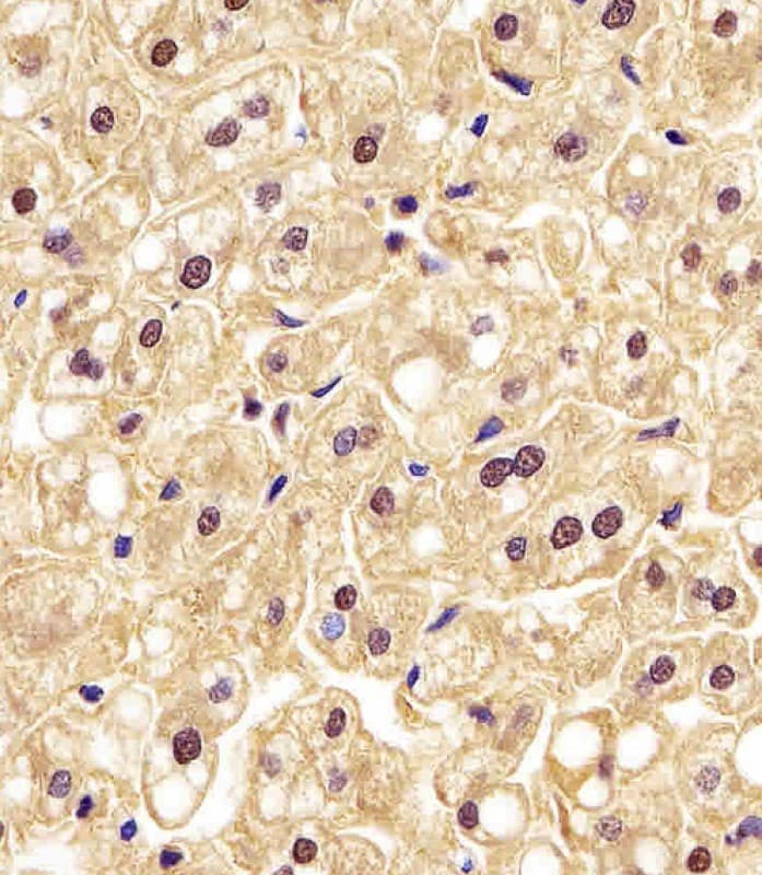 PGK1 / Phosphoglycerate Kinase Antibody (clone 1086CT10.2.1)