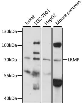 LRMP / JAW1 Antibody