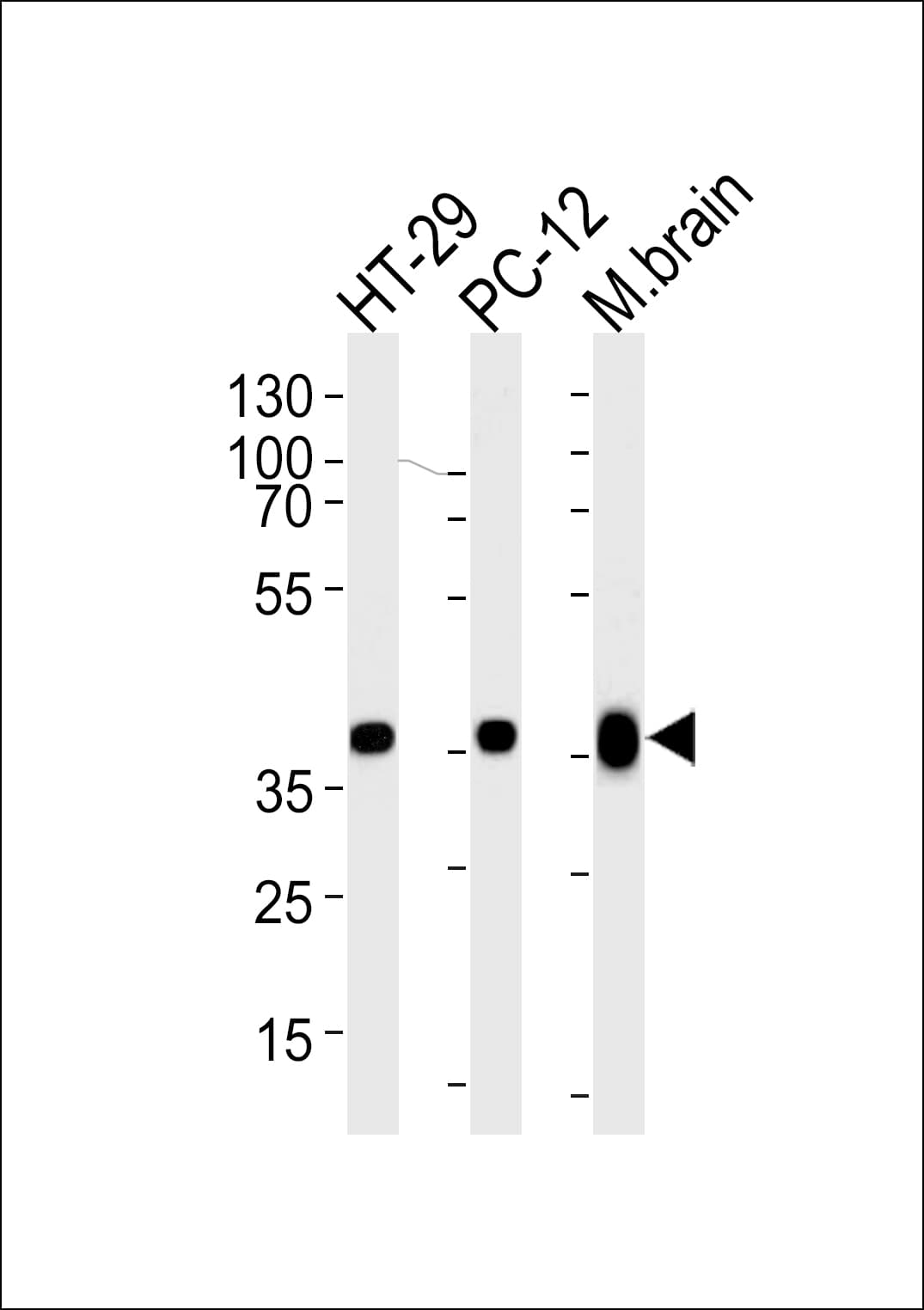 PPP1CB Antibody (aa298-327)