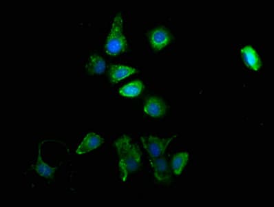 Tyrosinase Antibody (aa19-377)