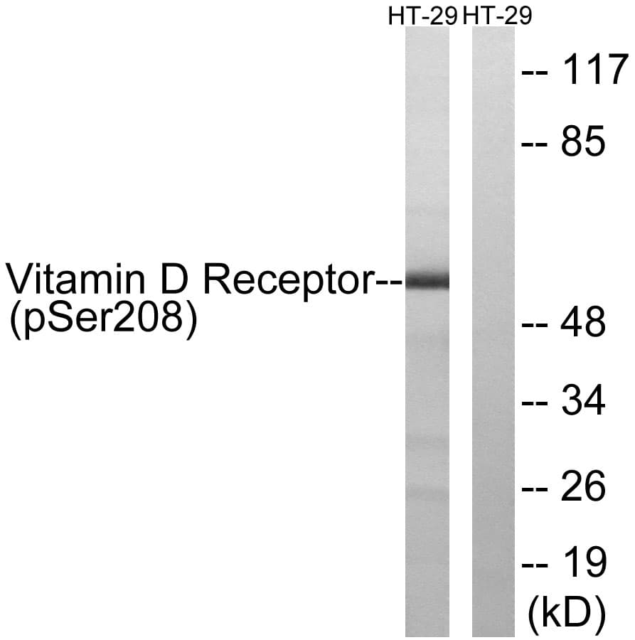 Polyclonal Rabbit anti-Human Vitamin D Receptor / VDR Antibody (phospho-Ser208, IF, WB)