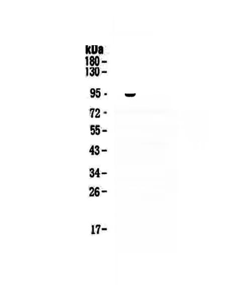 Polyclonal Rabbit anti-Human VCAM1 / CD106 Antibody (WB)
