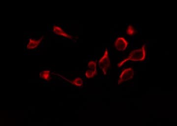 Polyclonal Rabbit anti-Human TNFRSF1B / TNFR2 Antibody (IF, WB)