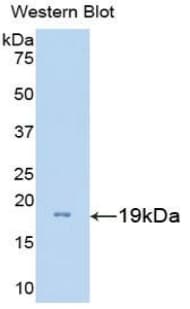 GNRH Antibody (aa22-140, FITC)