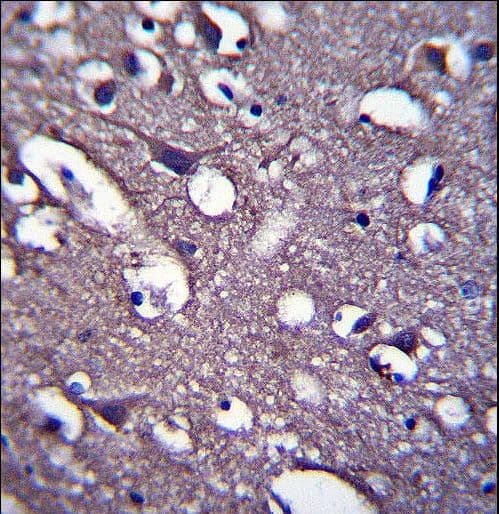 PRR18 Antibody (aa225-253)