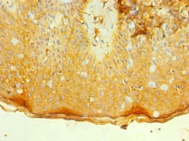 IL7R / CD127 Antibody (aa21-239)