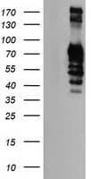 GOLM1 / GP73 / GOLPH2 Antibody (clone OTI5F4)