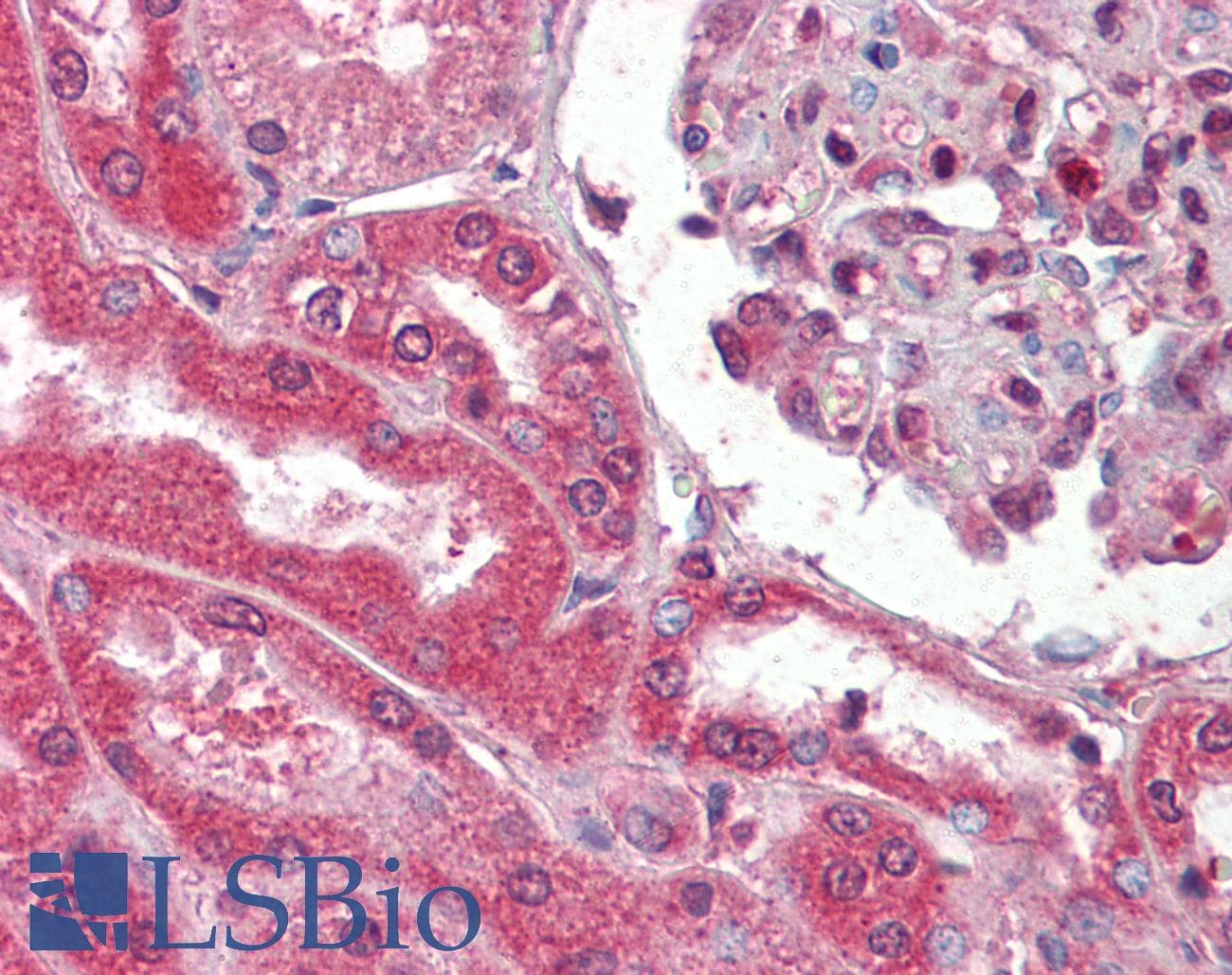 IHC-plus™ Collagen I Antibody