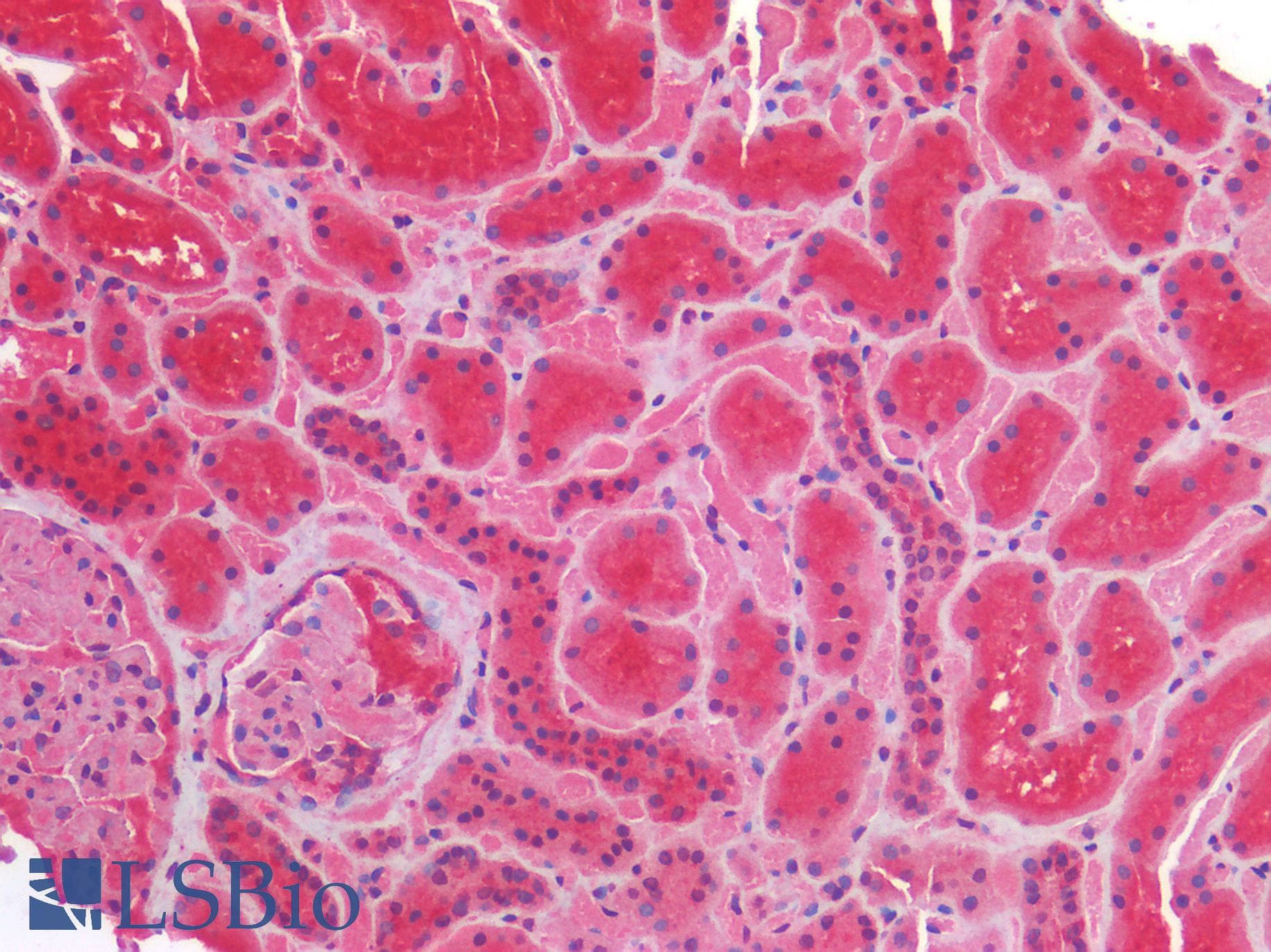 IHC-plus™ Polyclonal Rabbit anti-Human IGF1R / IGF1 Receptor Antibody (IHC)