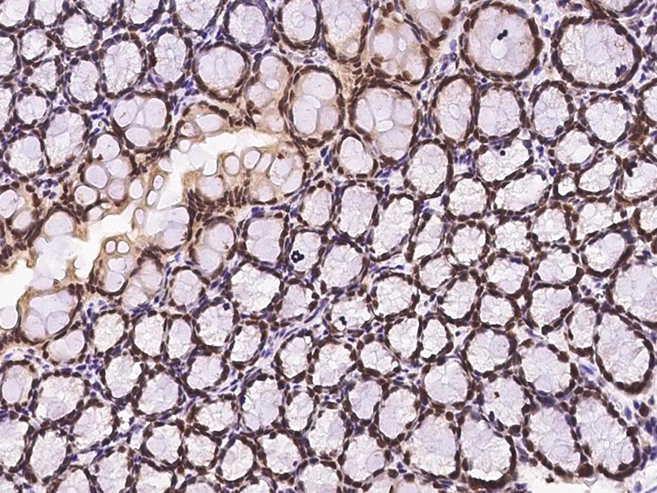 ECD Antibody (Preservative Free)