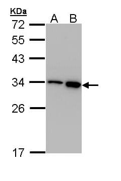 RPA2 / RFA2 / RPA34 Antibody (aa1-202)