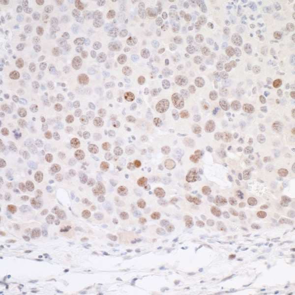 H2AFX / H2AX Antibody (phospho-Ser140)