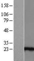 ANKRD39 Protein (Over-Expression Lysate Myc-DDK (Flag))