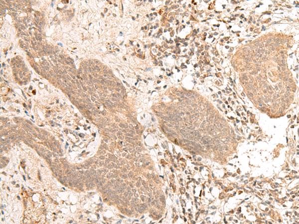 Polyclonal Rabbit anti-Human FIZ1 Antibody (IHC)