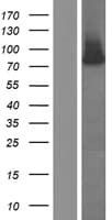 RNASEL / RNase L Protein (Over-Expression Lysate Myc-DDK (Flag))
