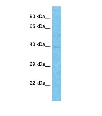 Polyclonal Rabbit anti-Human TFDP2 / DP2 Antibody (C-Terminus, WB)