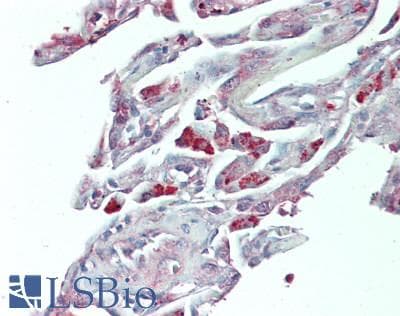 IHC-plus™ HNF1A / HNF1 Antibody (aa475-525)