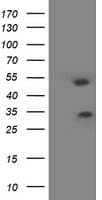 HOXC11 Antibody (clone OTI2A10)