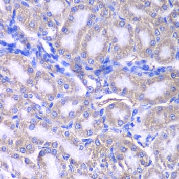 Polyclonal Rabbit anti-Human RMDN3 Antibody (IHC, WB)