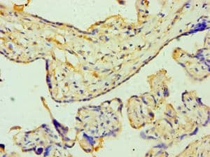ZNF346 Antibody (aa1-294)
