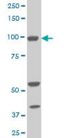 IHC-plus™ Monoclonal Mouse anti-Human ALDH1L1 Antibody (clone 3E9, IHC, IF, WB)