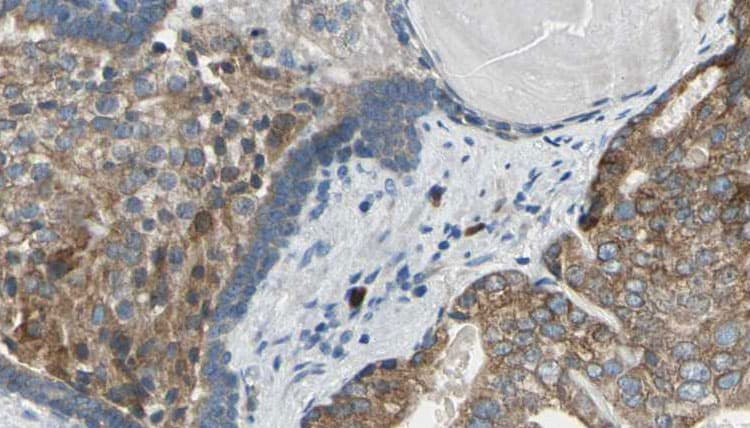 Polyclonal Rabbit anti-Human EIF4EBP1 / 4EBP1 Antibody (IHC, IF, WB)