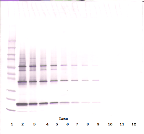 TNFSF10 / TRAIL Antibody