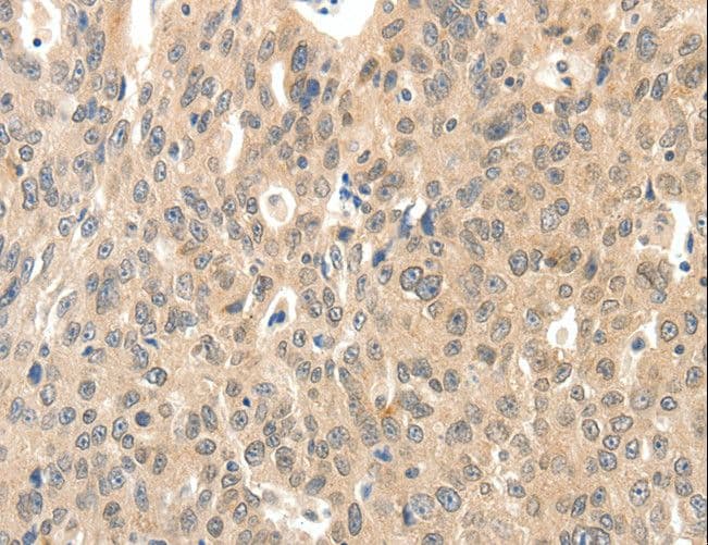 ROS1 / ROS Antibody