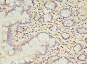 Polyclonal Rabbit anti-Human TCHP Antibody (IHC)