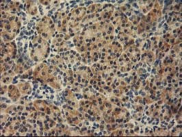 TBC1D21 Antibody (clone OTI1C7)