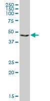 RING1 Antibody (clone 1D5)