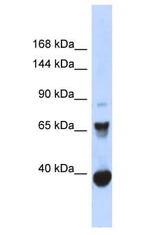 CHD6 Antibody (aa206-255)