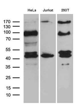 Monoclonal Mouse anti-Human SHARPIN Antibody (clone OTI1F4, aa1-326, WB)