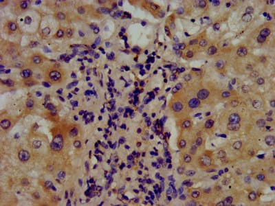 ARSE / Arylsulfatase E Antibody