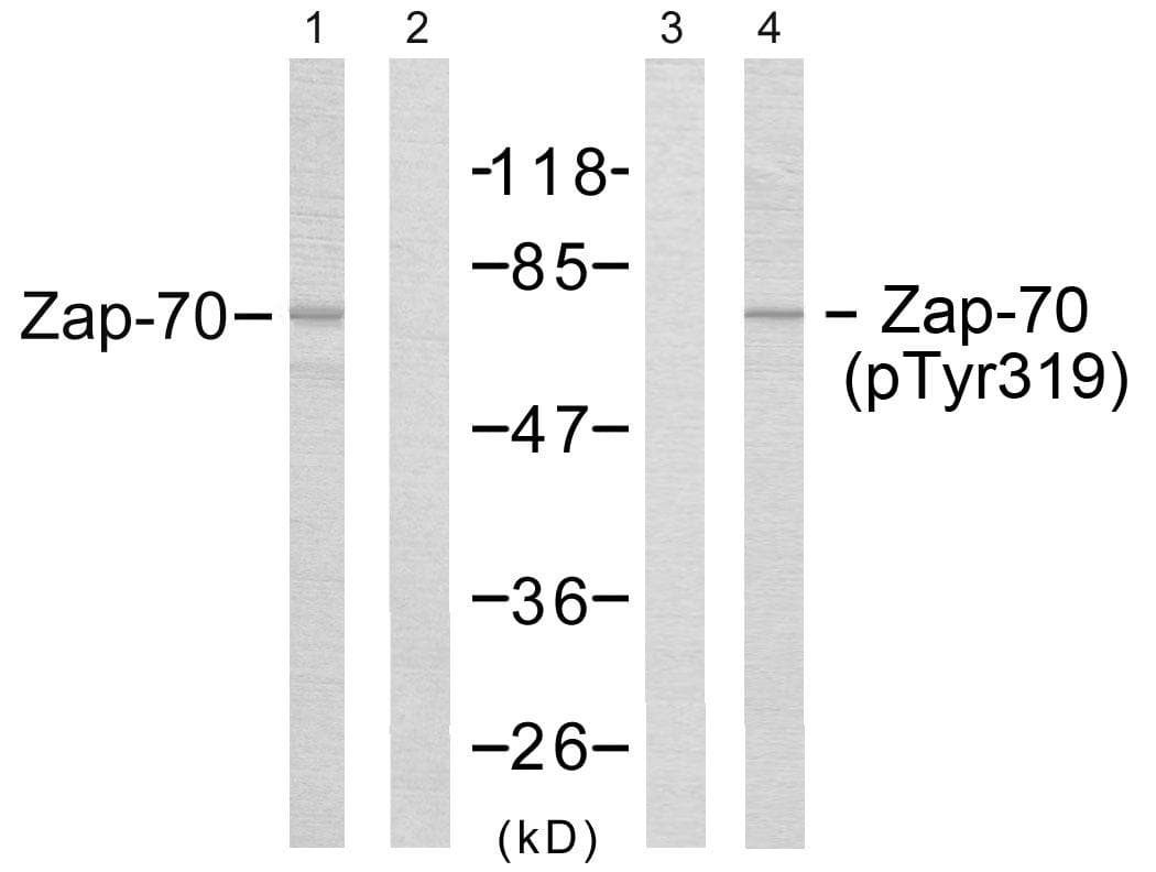 Polyclonal Rabbit anti-Human ZAP70 Antibody (phospho-Tyr319, WB)