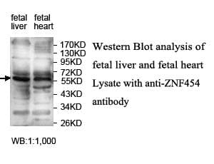 ZNF454 Antibody (aa151-404)