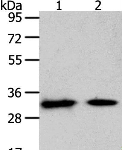 SLC25A4 / ANT Antibody