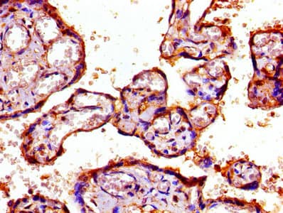 Polyclonal Rabbit anti-Human PSMD7 / MOV34 Antibody (IHC, WB)