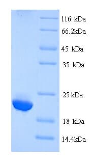 Human IGLL5 Protein (Recombinant His)