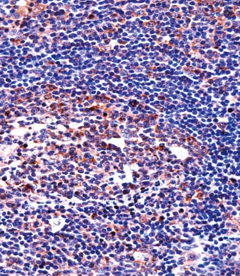 QPRT Antibody (aa206-234)